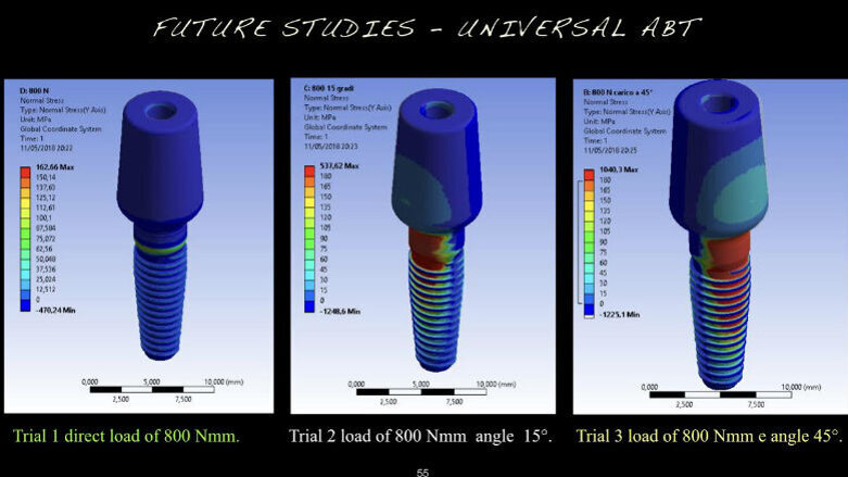 Analisi meccanica delle specifiche di tre diversi dispositivi di ritenzione protesica su impianti