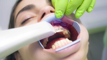 El engañoso arte de la prescripción de brackets