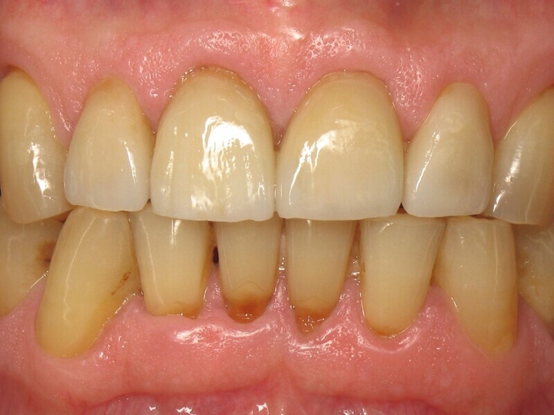 Fig. 1: Situation finale. 