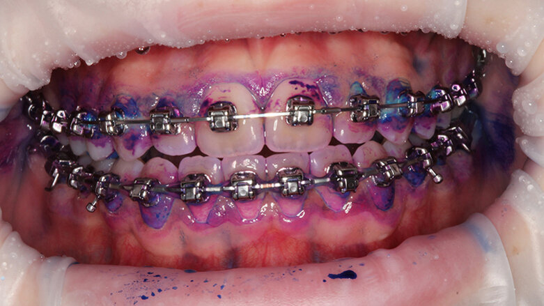 The orthodontic patient - From hell to heaven