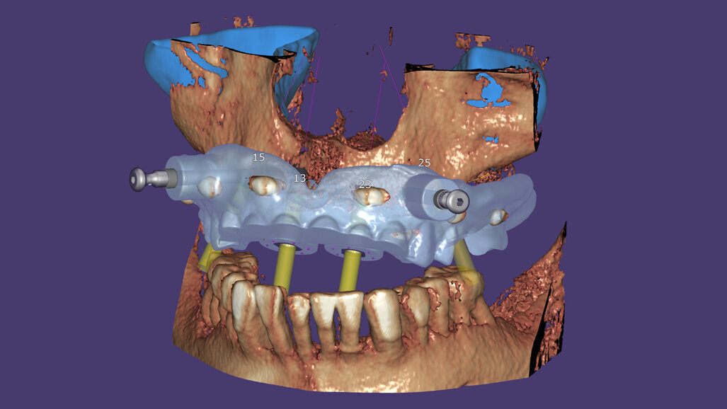 Nuevo exoplan 3.0 Galway ahora disponible