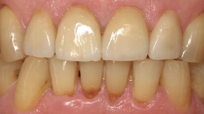 En busca de la sonrisa perdida (1)