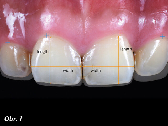 Obr. 1: Pohled před ošetřením