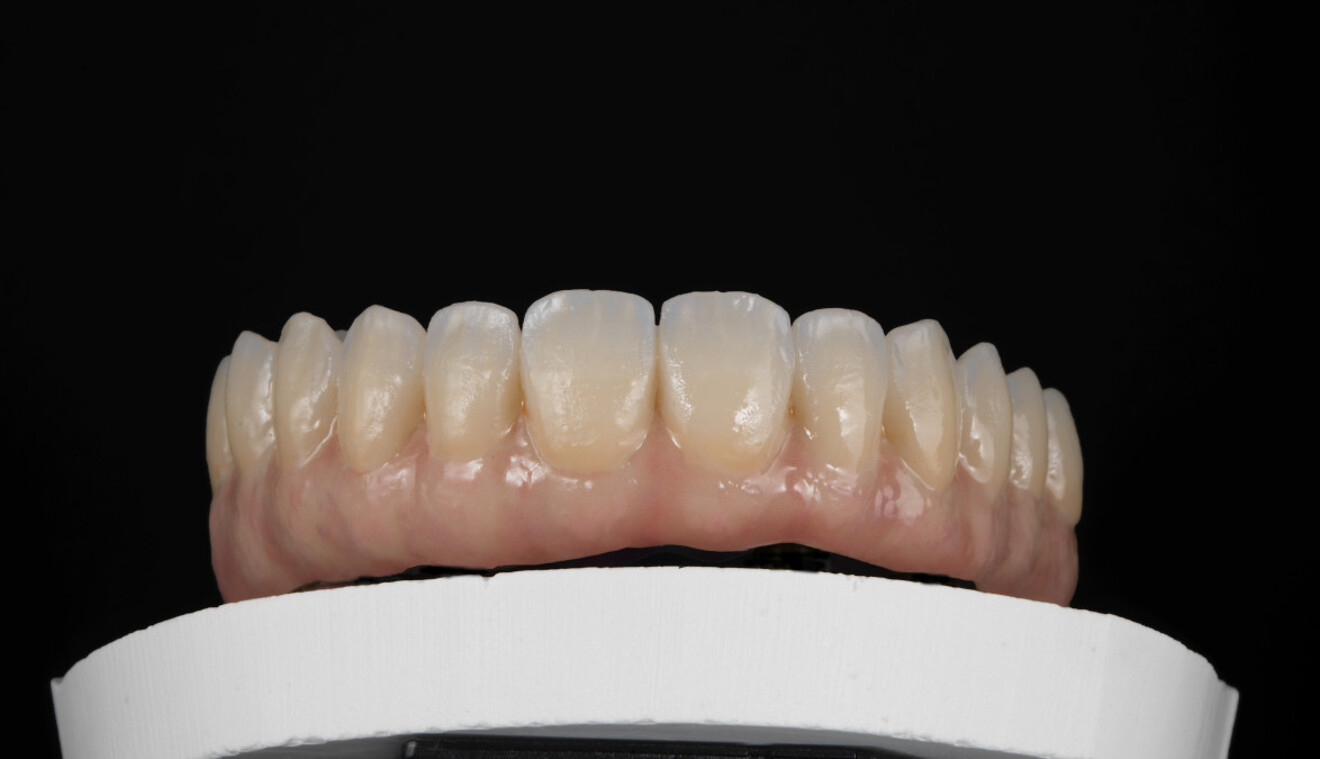 Fig. 10: Result after firing of GC Initial IQ Lustre Pastes ONE, GC Initial Spectrum Stains and GC Initial IQ Lustre Pastes NF Gum Shades.