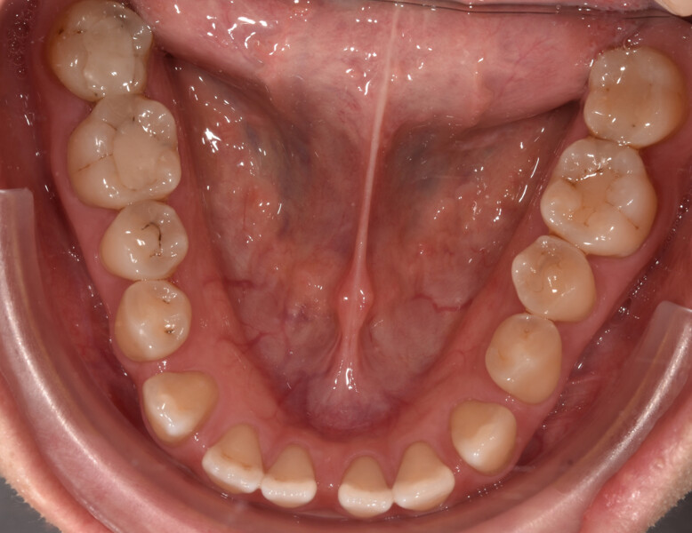 Fig. 2e