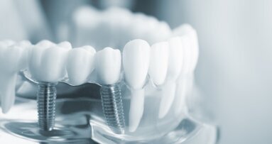 What is driving the European dental implant markets?