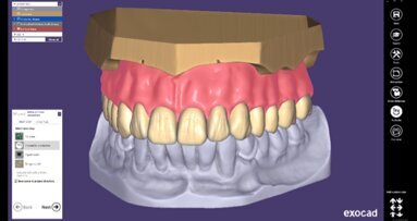 Out now: exocad releases DentalCAD 2.4 Plovdiv
