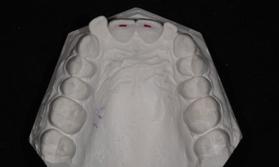 9. Gipsmodel initiële situatie