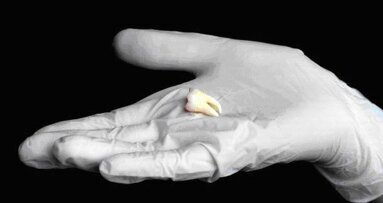 Nieuwe forensische tandentest maakt leeftijdsbepaling preciezer dan ooit