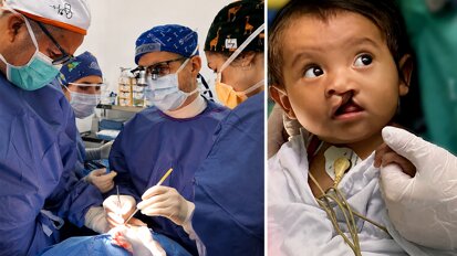 Donación de motor de implantología para cirugía de labio leporino