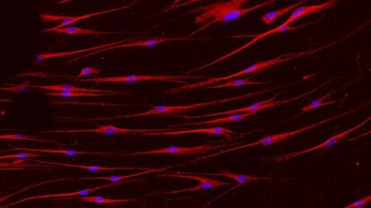 Des cellules non-vieillissantes de la muqueuse buccale peuvent être importantes pour la recherche sur les cellules souches