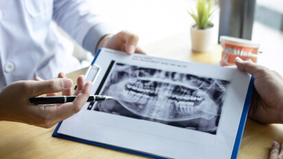 New research could prevent jaw damage for cancer patients in need of oral surgery New research could prevent jaw damage for cancer patients in need of oral surgery