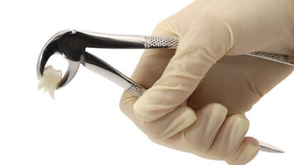 Utrata jednego zęba to kalectwo!