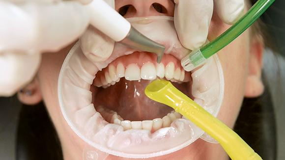 Cele 5 mituri privind polizarea cu aer, care vă vor face să vă regândiți protocoalele de igienă