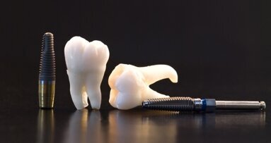 Naukowcy z Podlasia opracowują nowe implanty stomatologiczne