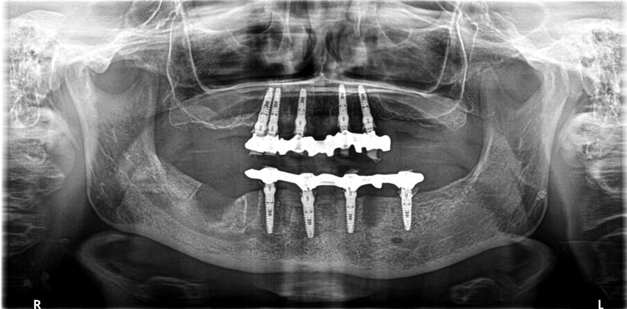 . Fig. 3_OPT impianti.