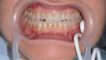 “Ergonomia Odontoiatrica”, benessere per il paziente e per il team-work