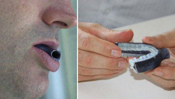 Apnea notturna: il nuovo boccaglio stampato in 3D può aiutare migliaia di pazienti