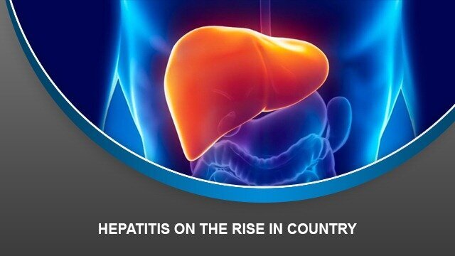 Hepatitis on the rise in country