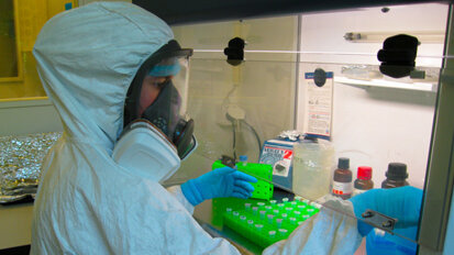 Forscher: Zahnstein ist Gedächtnis der Evolution Forscher: Zahnstein ist Gedächtnis der Evolution