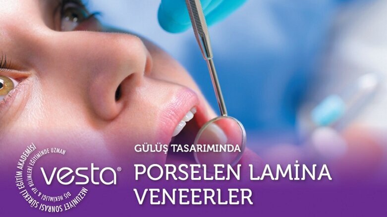 Gülüş Tasarımında Porselen Lamina Veneer Eğitimi