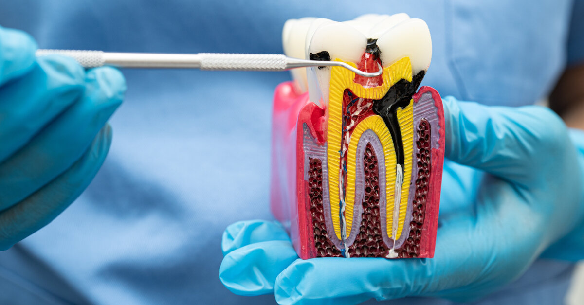 Researchers identify gene teamwork regulating tooth root formation