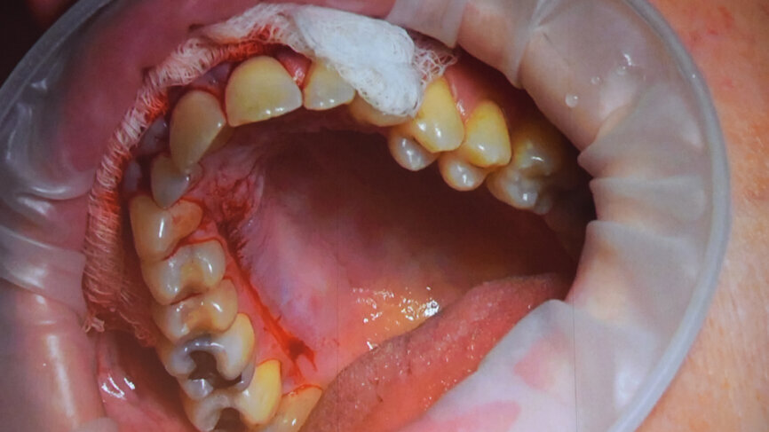 The live surgeries ran in parallel, allowing attendees to follow the critical steps of each method.