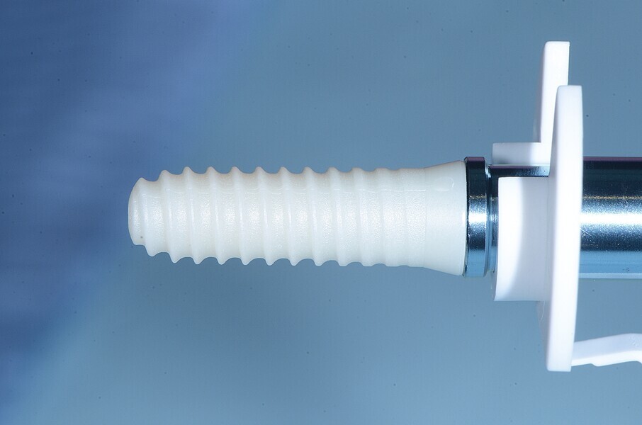 Fig. 17: Pose de l’implant deux pièces en céramique au niveau tissulaire.