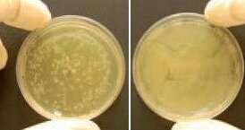 Prozone potwierdza skuteczność ozonu w leczeniu stomatologicznym