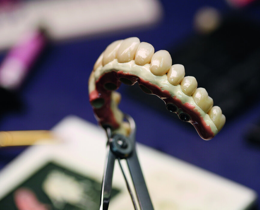 Fig. 18: Preparation of the structure for gum modelling. (Photo: courtesy of Inter-dent laboratory) 