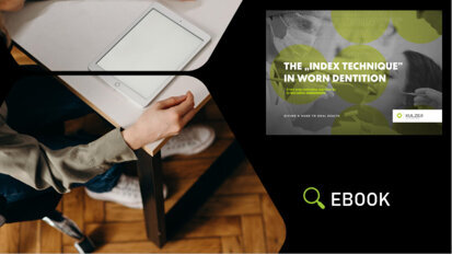 Μια νέα μη επεμβατική προσέγγιση στις αποκαταστάσεις: Η “Τεχνική Index” σε οδοντοφυΐα με αποτριβές