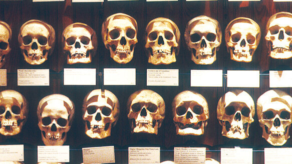 Philadelphia museum features 20,000 medical anomalies