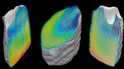 Una nueva técnica visualiza las nanoestructuras de los dientes Una nueva técnica visualiza las nanoestructuras de los dientes
