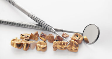 Aufruf zur Zahngoldspende für kostengünstige Augenmedizin