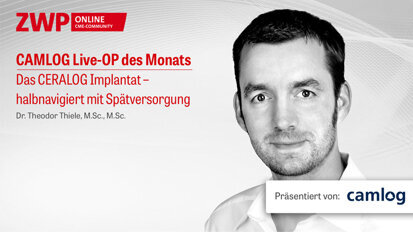 1 CME-Punkt: CAMLOG Live-OP mit Dr. Theodor Thiele im Archiv 1 CME-Punkt: CAMLOG Live-OP mit Dr. Theodor Thiele im Archiv