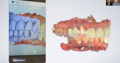 Come i flussi di lavoro digitali guidati dalla scansione intraorale migliorano la collaborazione tra studio odontoiatrico e laboratorio