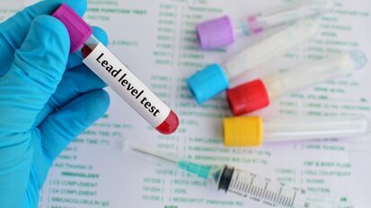 Tap water good for teeth but may cause higher blood lead levels Tap water good for teeth but may cause higher blood lead levels