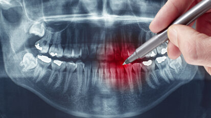 Biomarker machen Knochenprozesse sichtbar
