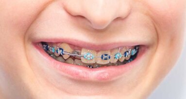 Σιδεράκια Do-it-Υourself