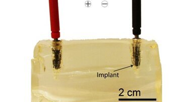 Wissenschaftler setzen Implantate unter Strom