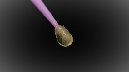 Interview: “A multi-step universal adhesive is a logic next evolution” Interview: “A multi-step universal adhesive is a logic next evolution”