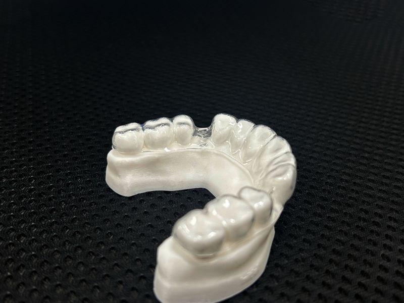 Fig. 13a: Comparison of fit between a thermoformed PETG aligner and a 3D-printed Shape Memory Aligner. The thermoformed PETG aligner shows trim line fit. 
