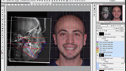 Comunicazione e progettazione software assistita open source utile alla stampa 3D del mock up
