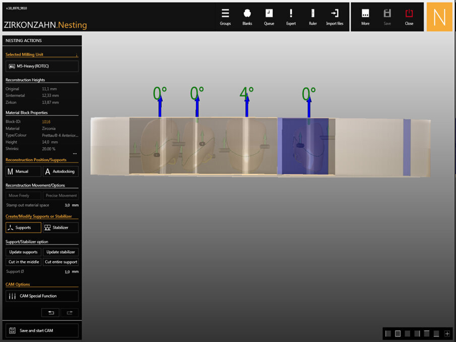 Fig. 4: Nesting of the zirconia crowns, lateral view.