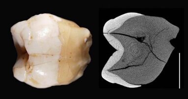 Des fossiles dentaires à l’origine d’un doute sur l'arrivée des humains dans l'Asie du Sud-Est