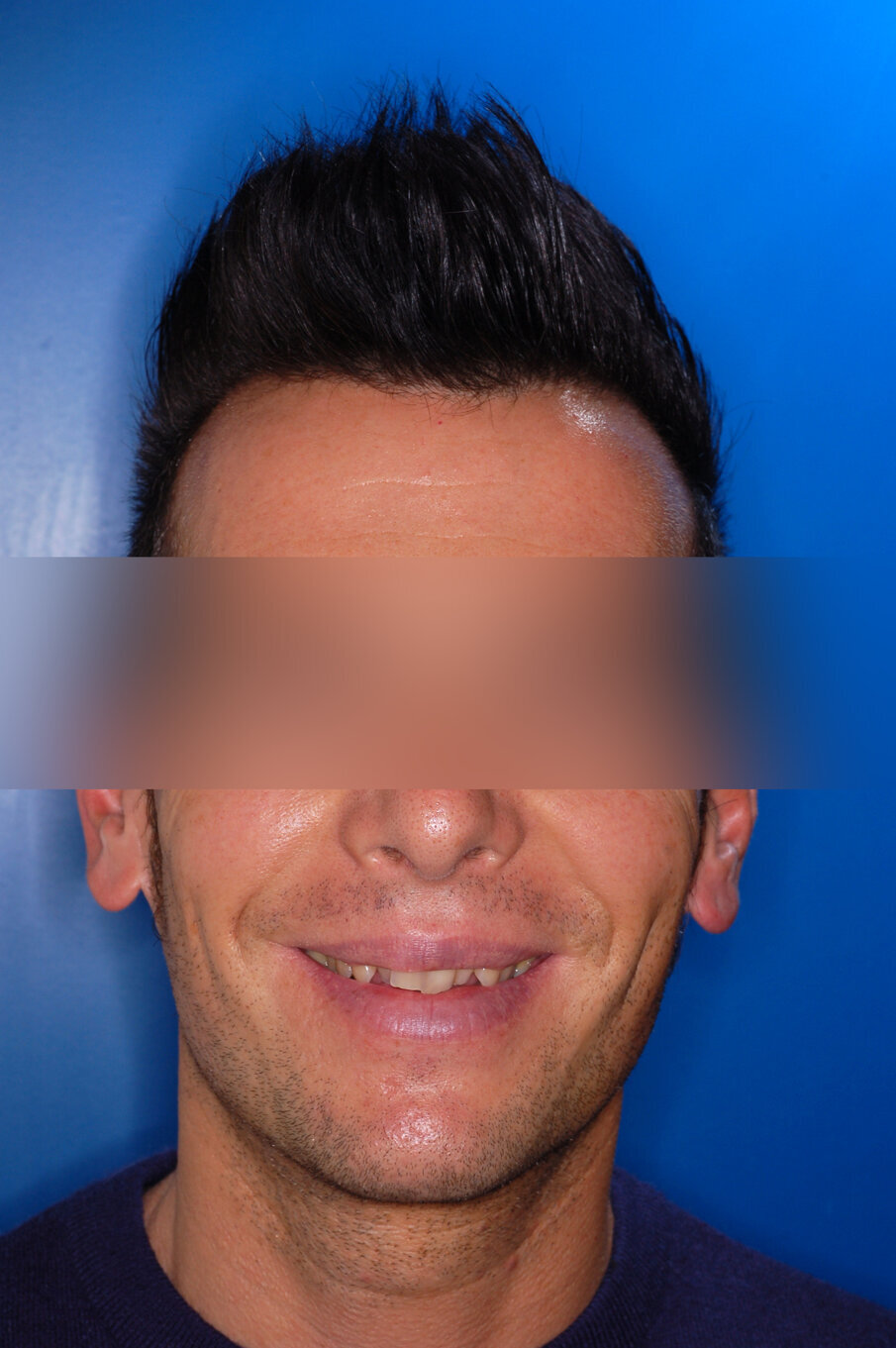 Figg. 1-8_Fotografie facciali e intraorali pre-trattamento.