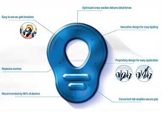 AlastiK Lingual Ligatures for the Incognito Appliance System AlastiK Lingual Ligatures for the Incognito Appliance System