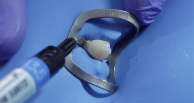 Create natural gloss instantly with CLEARFIL MAJESTY ES Flow