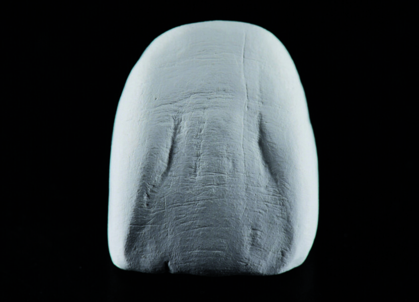 Fig. 6b : Magnifiques résultats après le traitement de surface manuel.