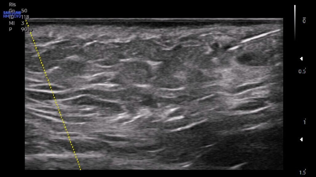 Qualità e sicurezza in medicina estetica del volto: il ruolo  dell’ecografia ambulatoriale